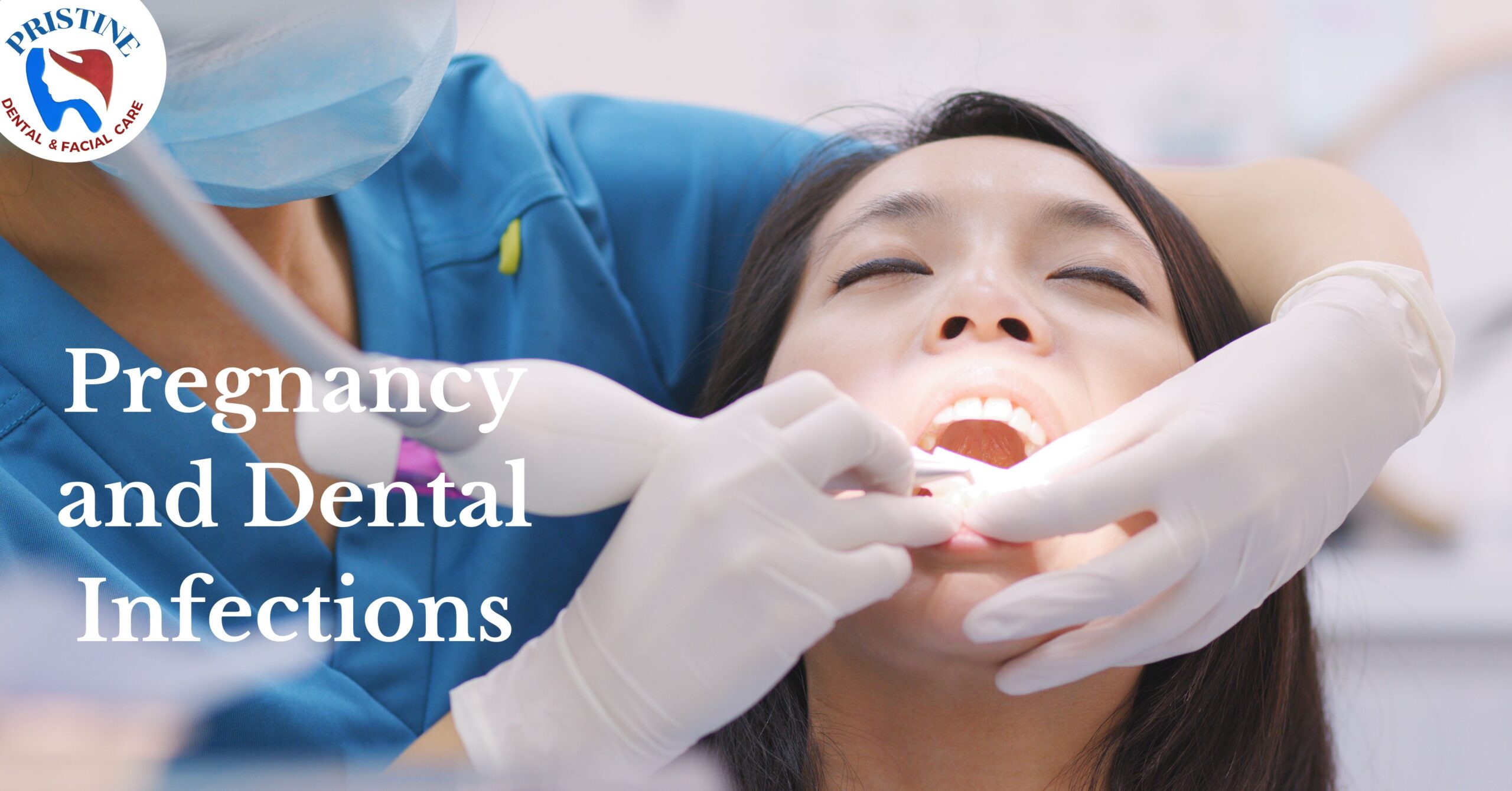 Pregnancy and dental infections