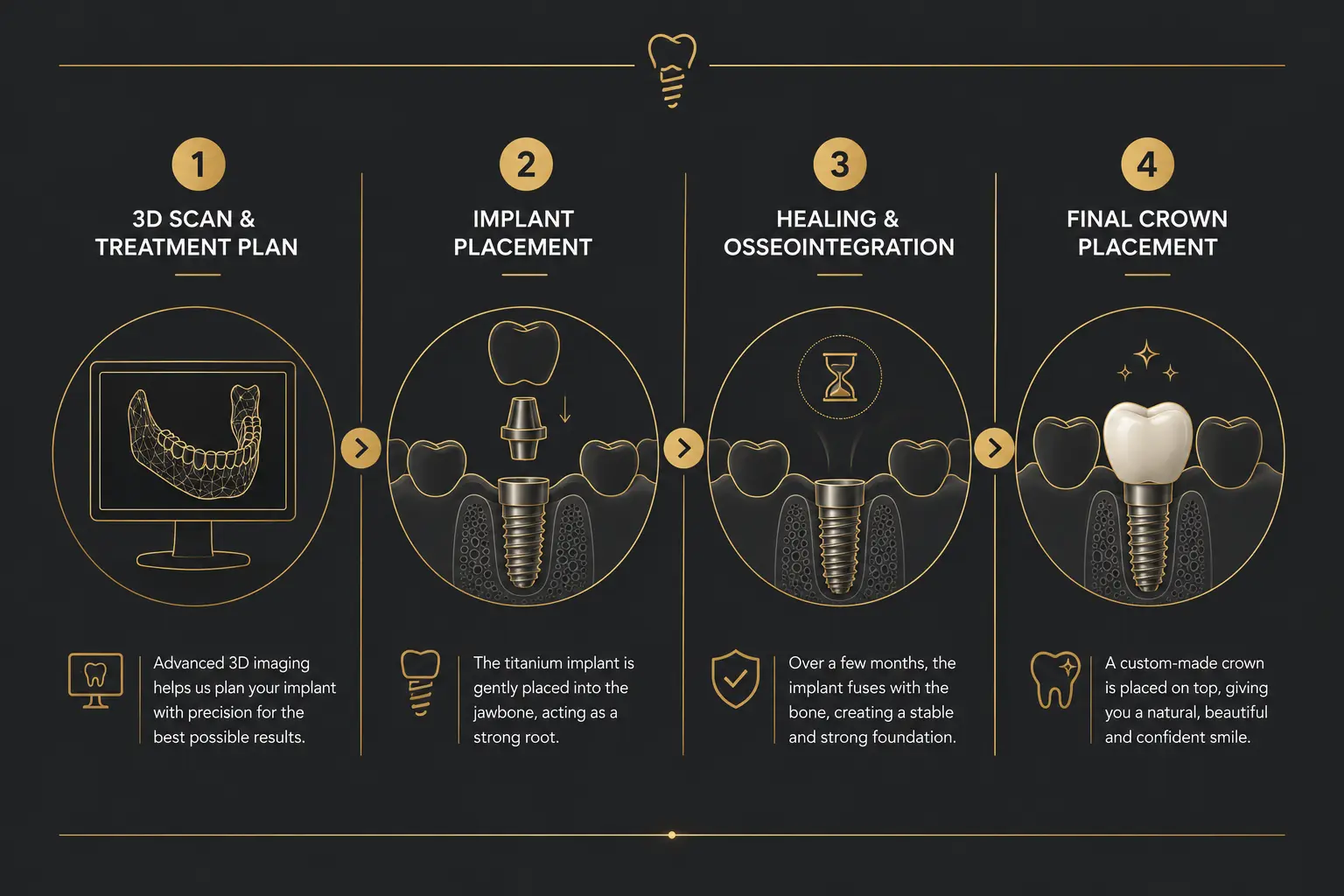Step-by-step dental implant placement procedure illustration