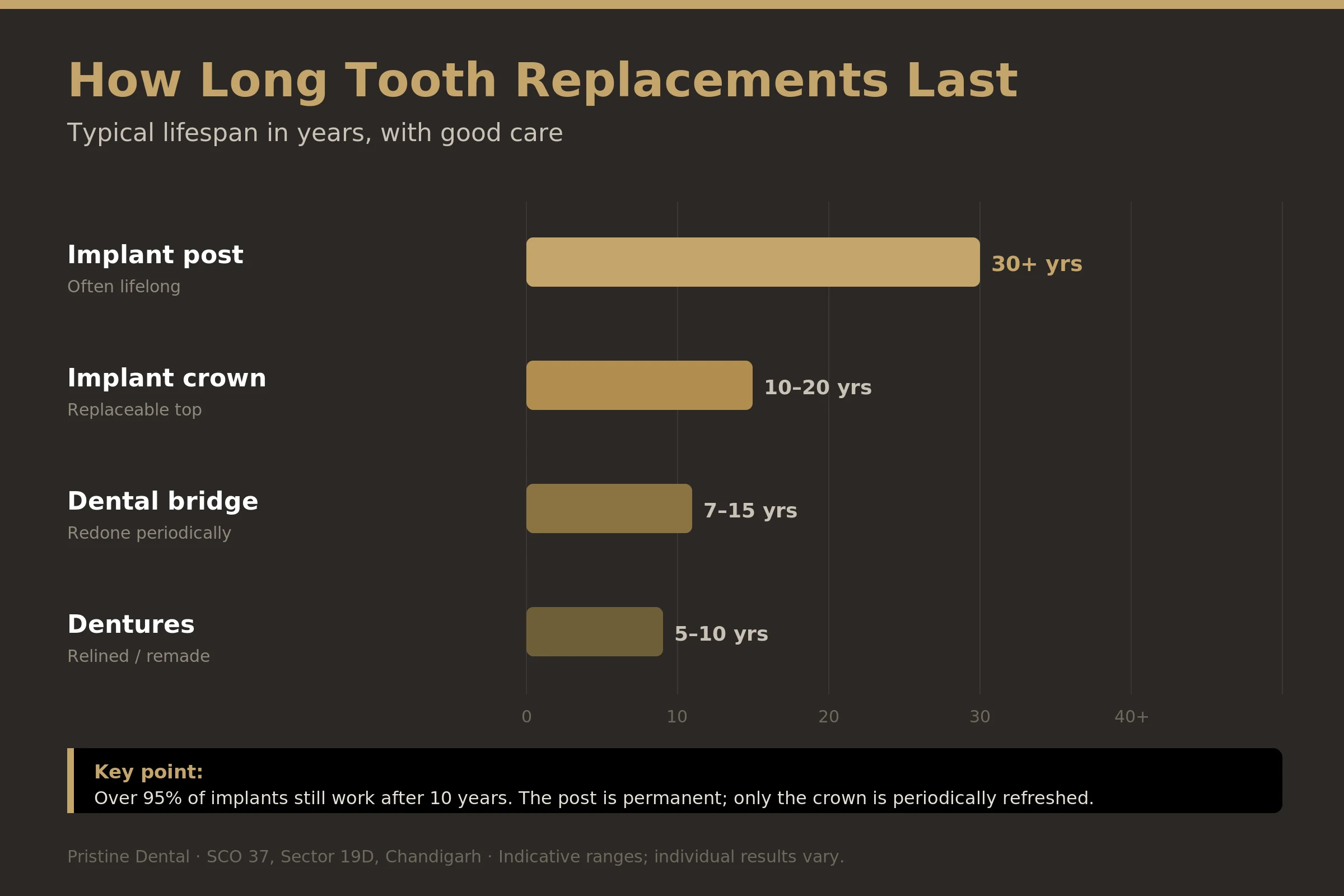 Chart comparing the lifespan of dental implant post, crown, bridge and dentures