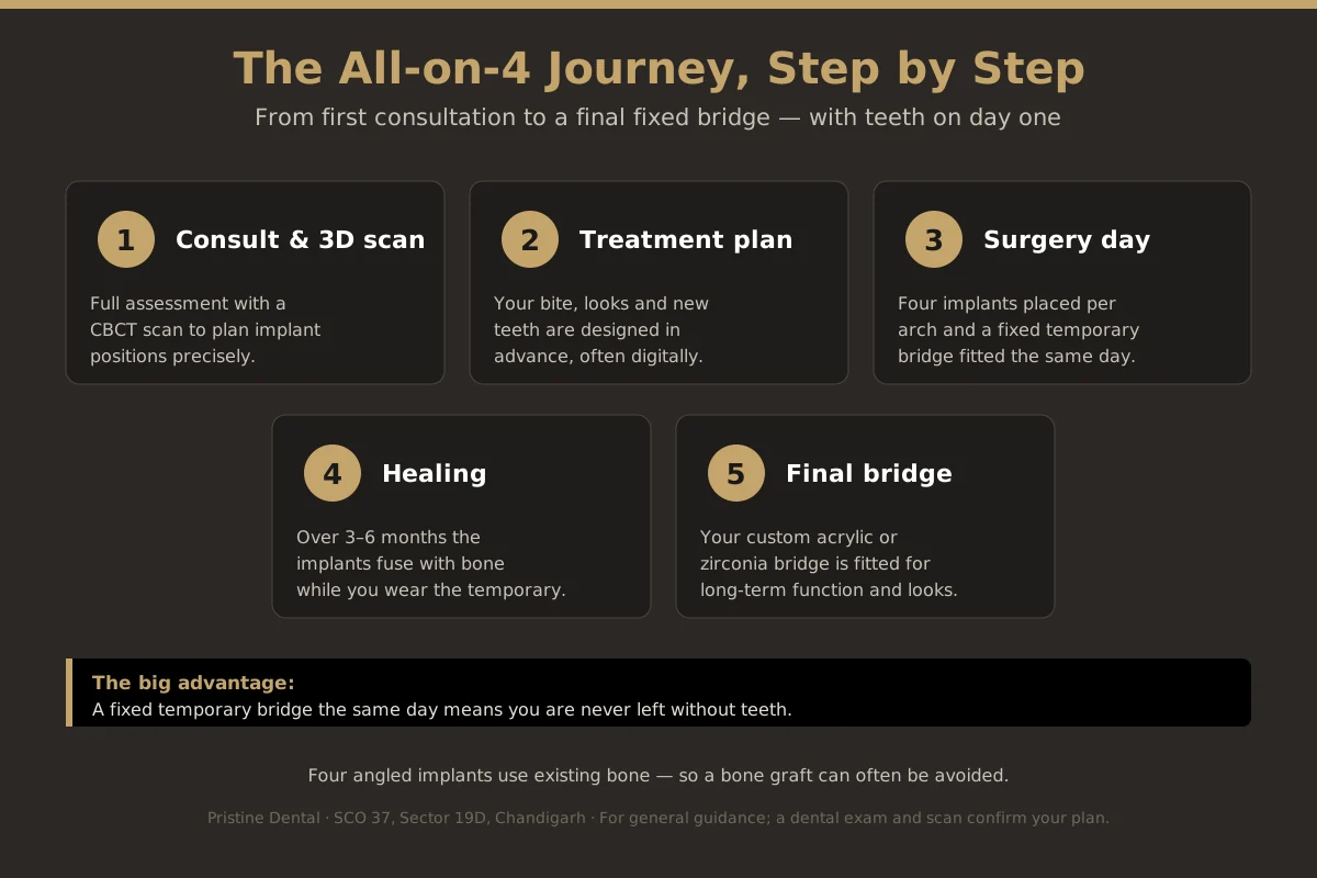 Step by step All-on-4 dental implant procedure from consultation to final fixed bridge