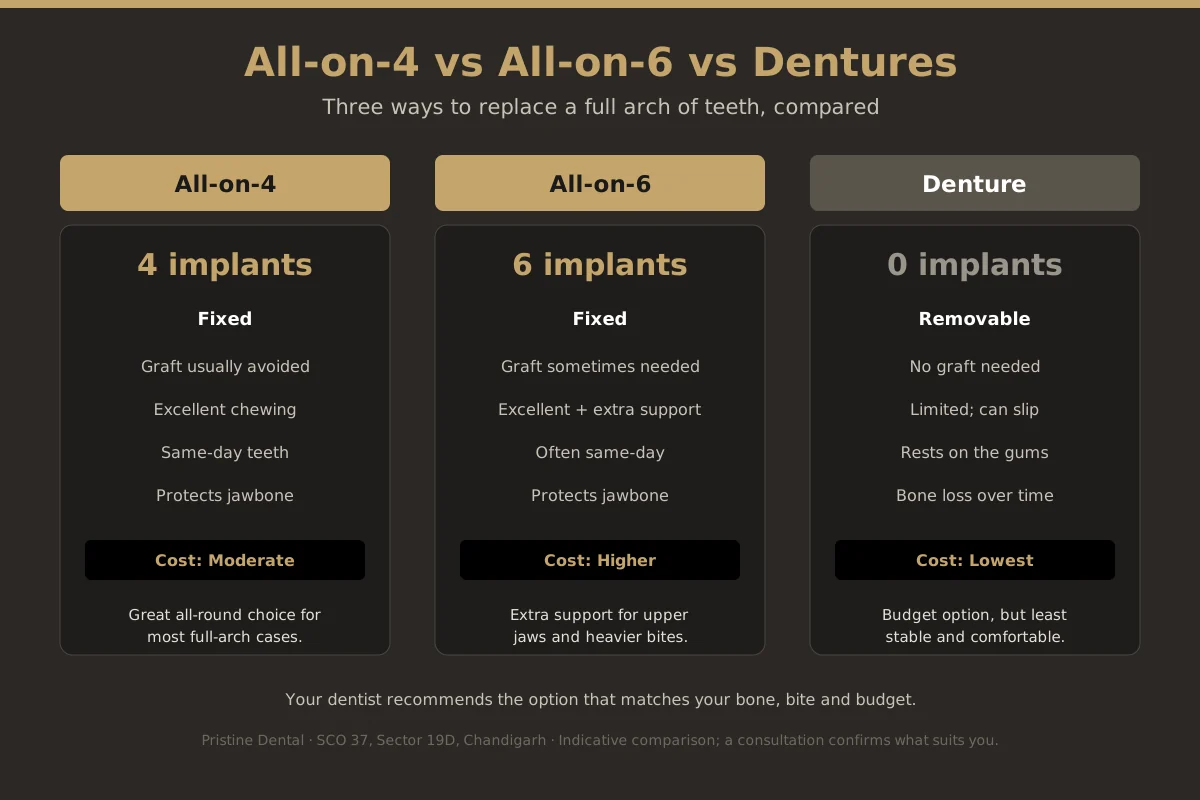 Comparison of All-on-4, All-on-6 and traditional dentures for full-mouth tooth replacement