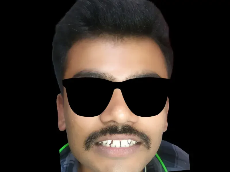 Before veneers smile makeover at Pristine Dental, Chandigarh